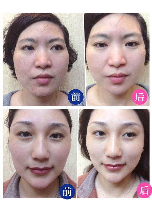 韩国皮肤管理 揭秘韩国女士好皮肤的秘诀